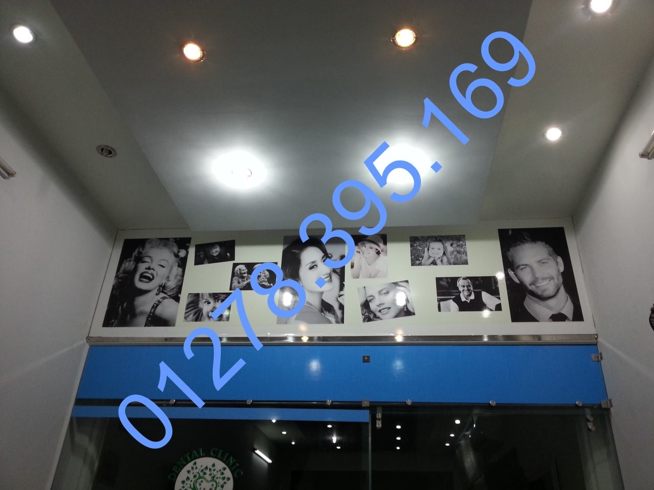 nha khoa bao chau 03